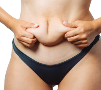 how to tighten loose skin after weight loss